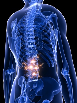 Rückenschmerzen im Lendenwirbel, Ursachen und Behandlung
